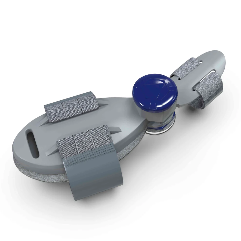 Alignex™ Bunion Fix