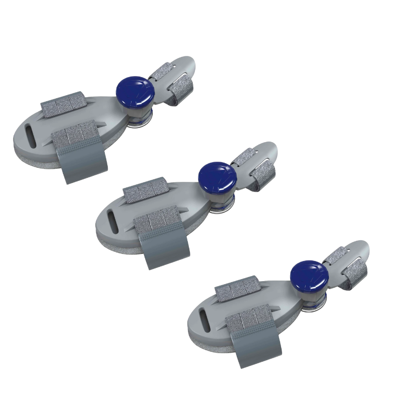 Alignex™ Bunion Fix